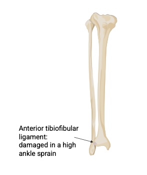 High ankle sprain anatomy